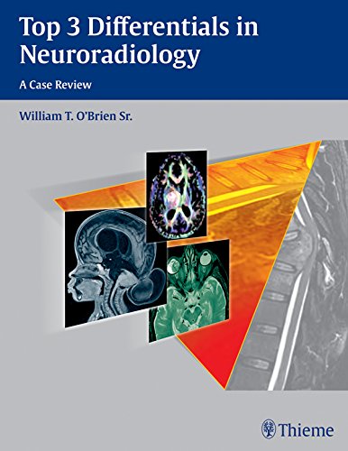 Top 3 Differentials in Neuroradiology