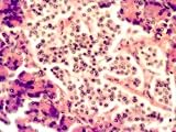 Insulin Production Site Islet of Langerhans Beta Photographic Poster Print, 32x24