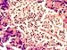 Insulin Production Site Islet of Langerhans Beta Photographic Poster Print, 16x12