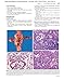 Differential Diagnosis in Surgical Pathology, 3e