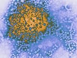 Hepatitis B Virus Photographic Poster Print, 32x24
