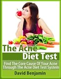 The Acne Diet Test