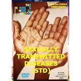 Sexually Transmitted Diseases (STDs)