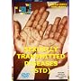 Sexually Transmitted Diseases (STDs)