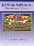 Review Saunders  / Dental Implants: The Art and Science