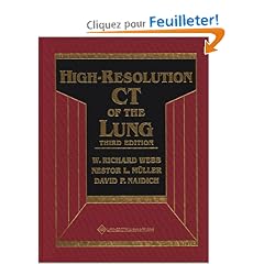 High-Resolution Ct of the Lung