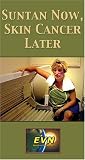 Review   / Suntan Now, Skin Cancer Later
