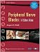 Peripheral Nerve Blocks...