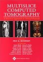 Multislice Computed Tomography: A Practical Approach to Clinical Protools.