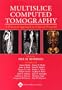 Multislice Computed Tomography: A Practical Approach to Clinical Protools.