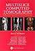 Book Multislice Computed Tomography: Principles, Practice, and Clinical Protocols