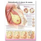 Understanding Breast Cancer Anatomical Chart in Spanish (Entendiendo el cáncer de mama)