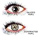 Iris Sphincter Muscle in Eye Photographic Poster Print, 16x16