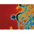AIDS Virus Budding from a T-Lymphocyte Photographic Poster Print, 32x24