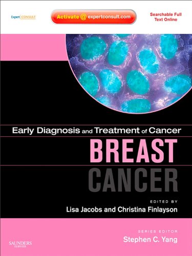 Early Diagnosis and Treatment of Cancer Series: Breast Cancer: Expert Consult (Early Diagnosis in Cancer)