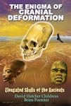 The Enigma of Cranial Deformation: El...