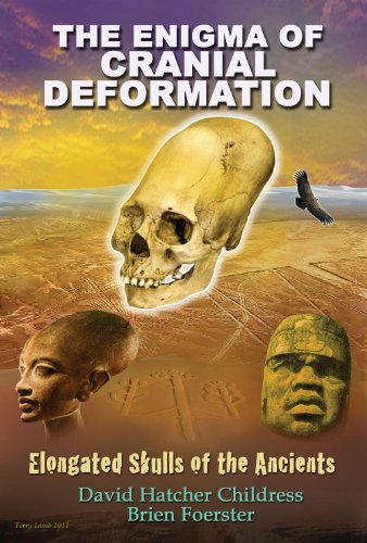 The Enigma of Cranial Deformation: Elongated Skulls of the Ancients