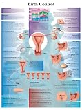 Anatomische Lehrtafel: Birth Control - 