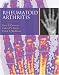 Book Rheumatoid Arthritis