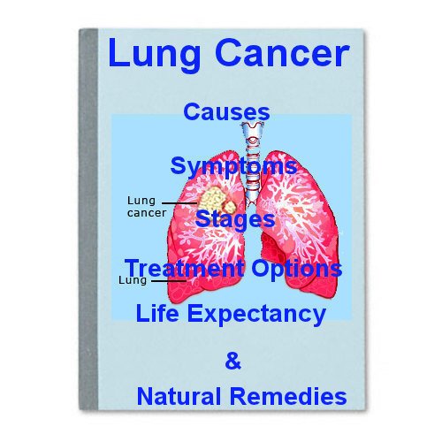 Lung Cancer - Causes, Symptoms, Stages, Treatment Options, Life Expectancy & Natural Remedies