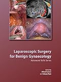 Laparoscopic surgery for benign gynaecology