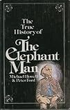 The true history of the 'Elephant Man'