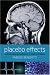 Placebo Effects: Understanding the mechanisms in health and disease
