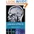 Placebo Effects: Understanding the mechanisms in health and disease