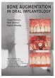 Bone Augmentation in Oral Implantology