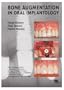 Bone Augmentation in Oral Implantology