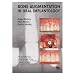 Bone Augmentation in Oral Implantology