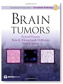 Brain Tumors (Consultant Pathology)