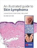 An Illustrated Guide to Skin Lymphoma
