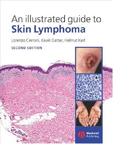 Skin-Cancer