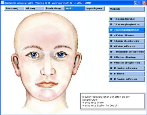 Schüsslersalze Software Repertorium Bio2010