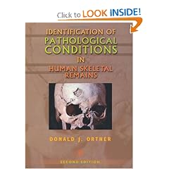Click here to buy Identification of Pathological Conditions in Human Skeletal Remains, Second Edition by Donald Ortner.
