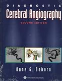 Diagnostic Cerebral Angiography
