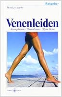 Alles rund um die Venenleiden