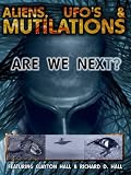 Aliens, UFO`s and Mutilations: Are We Next?