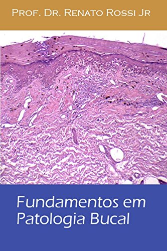 Fundamentos em Patologia Bucal (Portuguese Edition)