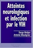 Atteintes neurologiques et infection par le VIH