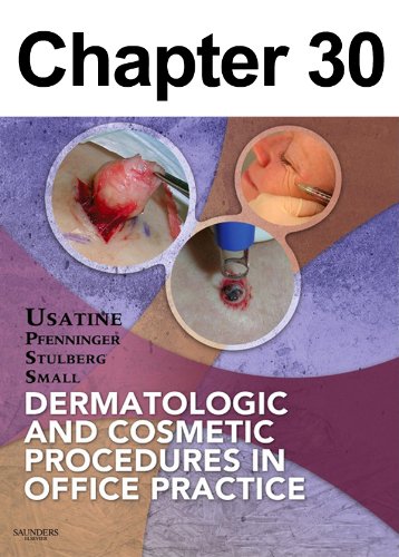 Tattoo Removal with Lasers: Chapter 30 of Dermatologic and Cosmetic Procedures in Office Practice