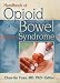 Books : Handbook of Opioid Bowel Syndrome