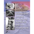 Radiographic Imaging for Regional Anesthesia and Pain Management by P. Prithvi Raj, Leland Lou, Serdar Erdine, and Peter S. Staats