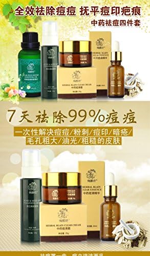 Acne Spots Facial Cream Face Care Acne Scar removal Cream Skin Care Treatment Whitening Cream Stretch Marks Moisturizing 4bottle