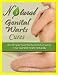 Natural Genital Warts Cures