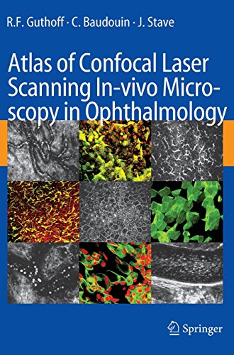atlas of confocal laser scanning in vivo microscopy in ophthalmology