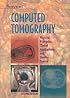 Computed Tomography: Physical Principles, Clinical Applications, and Quality Control