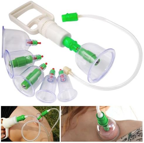 FreshGadegtz Cups Chinese Body Cupping Massage Set acupuncture Medical Vacuum Stress Relief