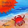 Shelly's Sunburn